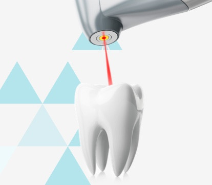 start_dental-laser